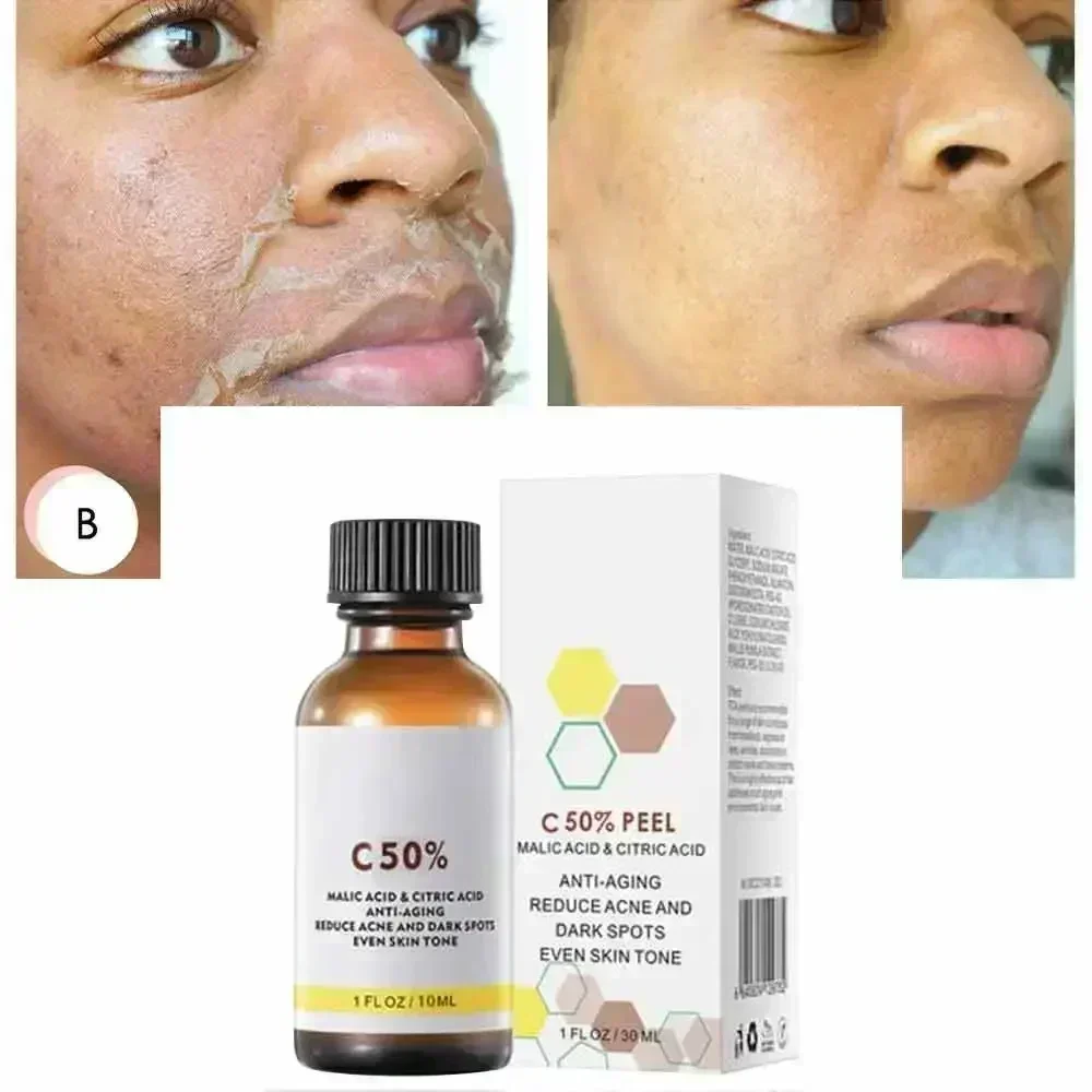 Salicylic Acid Face Facial Pee - Skincare Salicylic Acid review and price