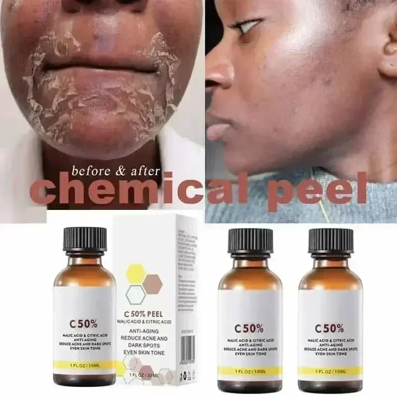 Salicylic Acid Face Facial Pee - Skincare Salicylic Acid review and price