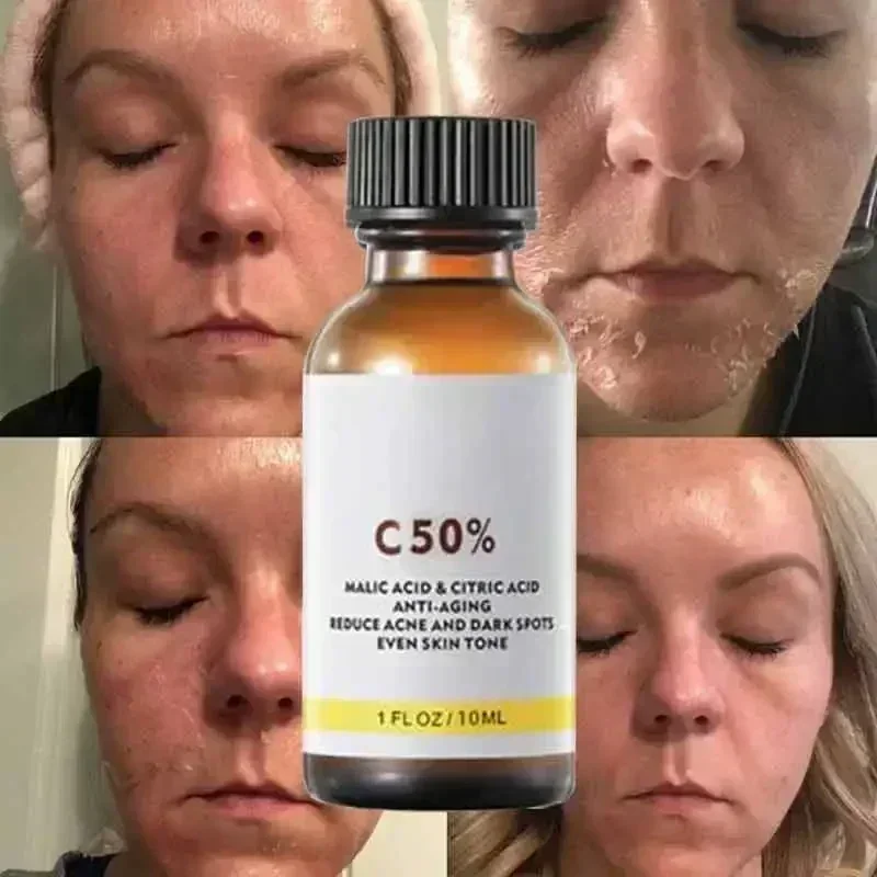 Salicylic Acid Face Facial Pee - Skincare Salicylic Acid review and price