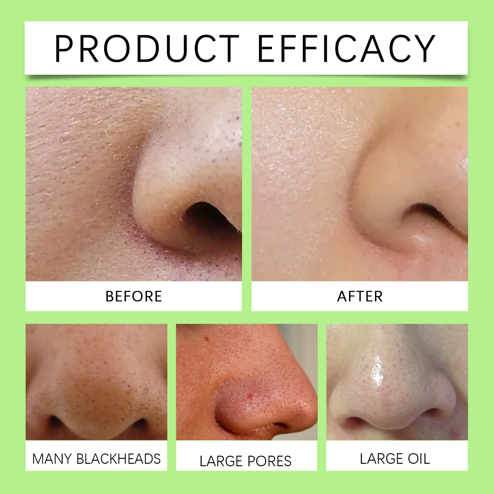 Bamboo Charcoal Nose Strips fo - Skincare Collagen review and price