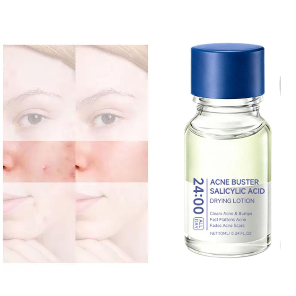 Salicylic Acid Essence Treatme - Skincare Salicylic Acid review and price