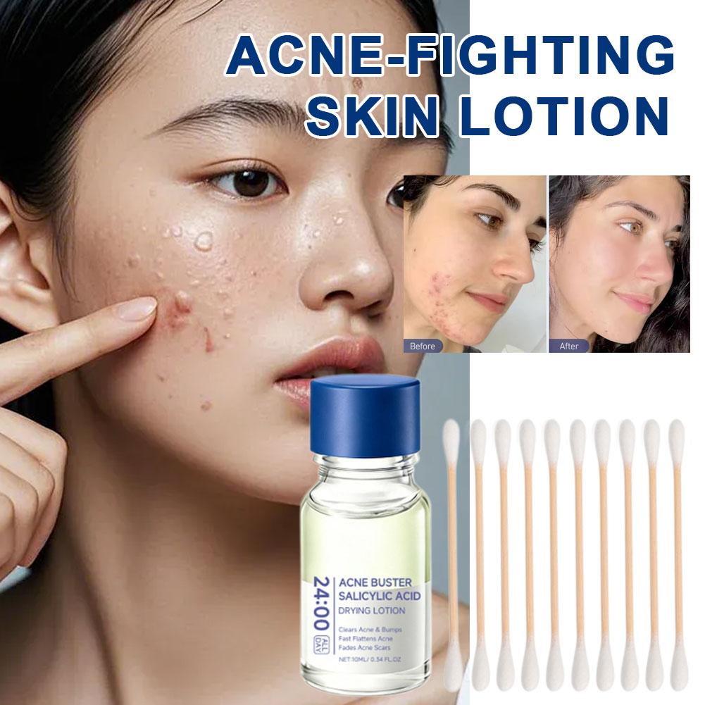 Salicylic Acid Essence Treatme - Skincare Salicylic Acid review and price