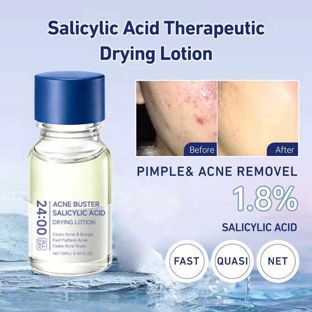 Salicylic Acid Acne Buster Rem - Skincare Salicylic Acid review and price